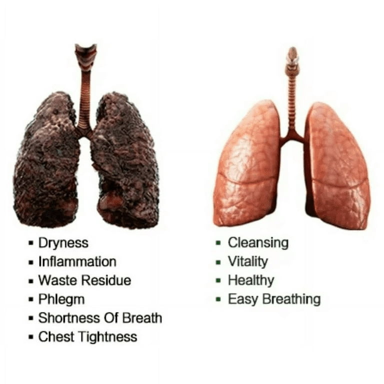 Herbal Lung Cleanse Mist, Powerful Lung Support, Natural Herbal Extract  Cleanse Mist Powerful Lung Cleanse Respiratory