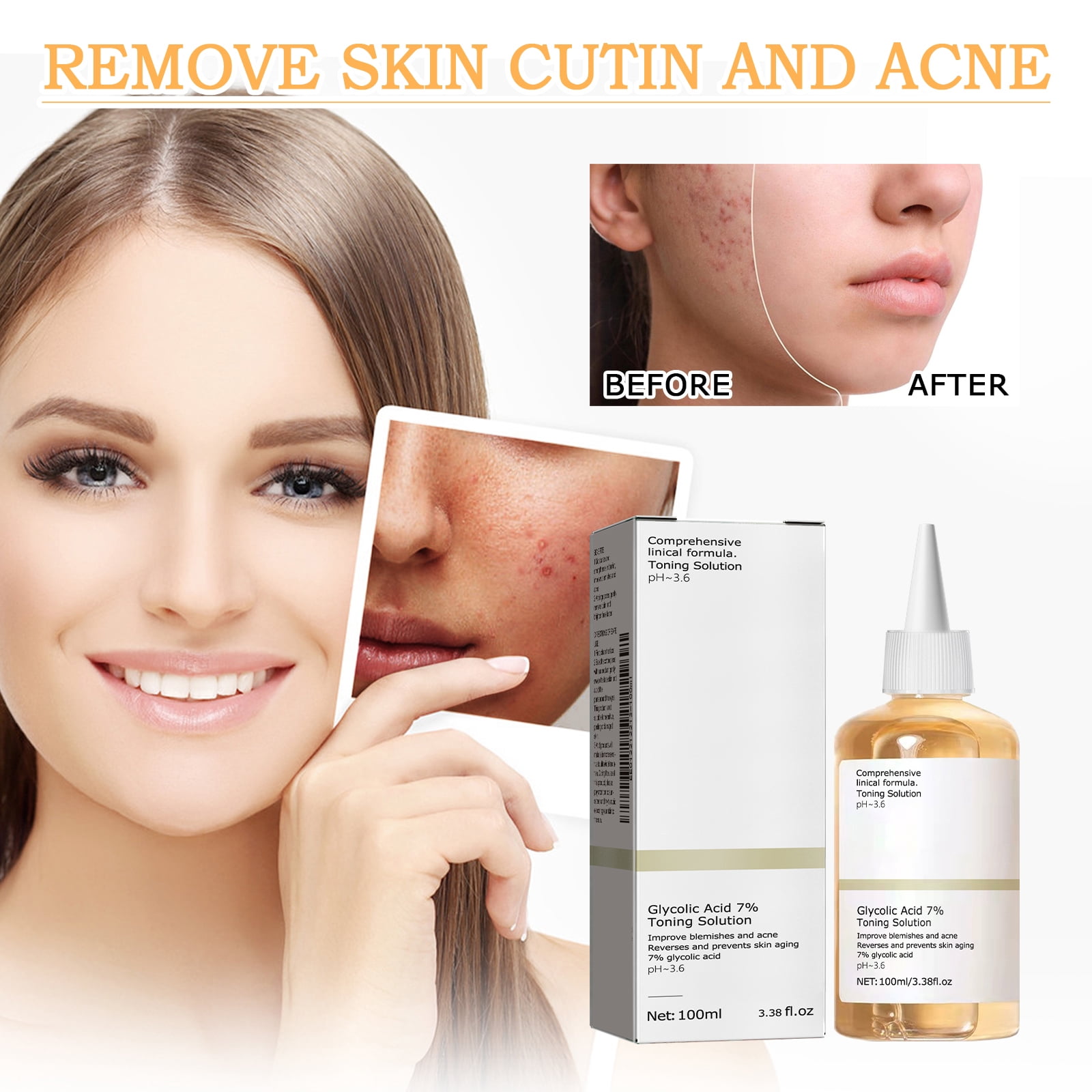 Alvantor Glycolic Acid Exfoliating Face Toner, Hydrating & Pore Minimizing, 3.38 fl oz