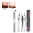 thumbnail image 4 of CXK99 on Clearance Blackhead Remover Tweezers, Professional Facial Blackhead Remover, Set of Precision Tweezers for Skin Care, Blackhead Extraction Tweezers for Sensitive Skin, 4 of 8