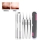 thumbnail image 5 of Xihbxyly Kit de Eliminación de Puntos Negros, Extractores Profesionales de Acero Inoxidable, Mango Antideslizante, Estuche Portátil, Rutina de Cuidado de La Piel, Artículos Esenciales de Belleza para, 5 of 6