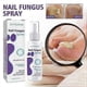thumbnail image 2 of 100ML Medinail Fungus Repair Spray For Foot,Nail, Soft Nail, Yellow Hair Care, 2 of 5