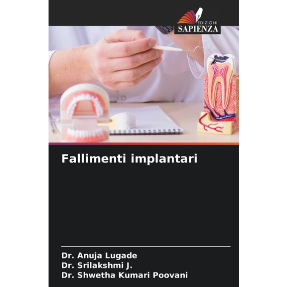 Fallimenti implantari, (Paperback)