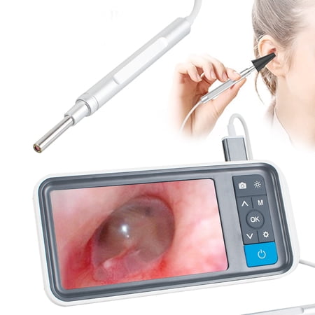 Rechargeable Digital Otoscope 3.9mm Lens Ear Inspection Camera 4.5 inch Color Screen Ear Scope with 6 LED Lights for Ear Wax Removal
