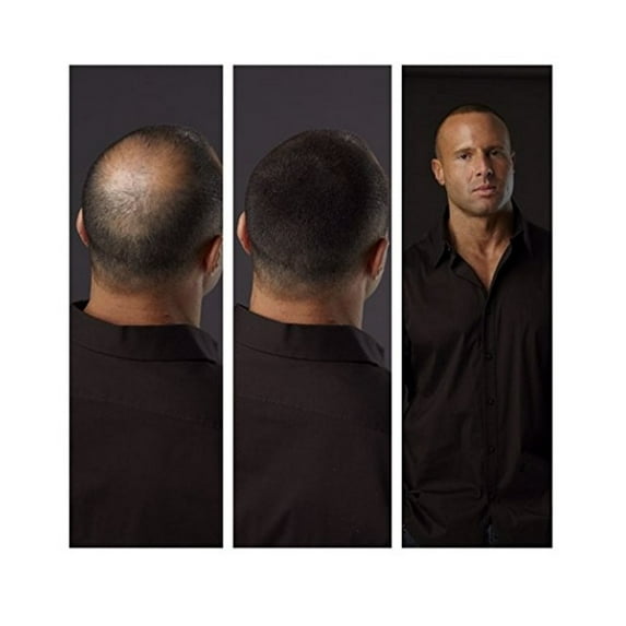 HAIR ILLUSION - 100% Real Human Hair Fibers - Not Synthetic - For Men & Women, Premium Hair Building Formulation, Black - 18g