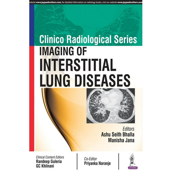 Clinico Radiological Series: Imaging of Interstitial Lung Diseases (Paperback)