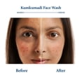 thumbnail image 4 of Jabón facial Blue Nectar Kumkumadi Brightening Saffron 100 ml, 4 of 7