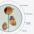 thumbnail image 6 of Milue Pathological Kidney Anatomy Model Shows Symptoms of Diabetes, 6 of 15