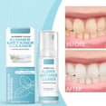 thumbnail image 3 of Get That Million Dollar With Braces Cleaning For Teeth And Braces Care!, 3 of 6