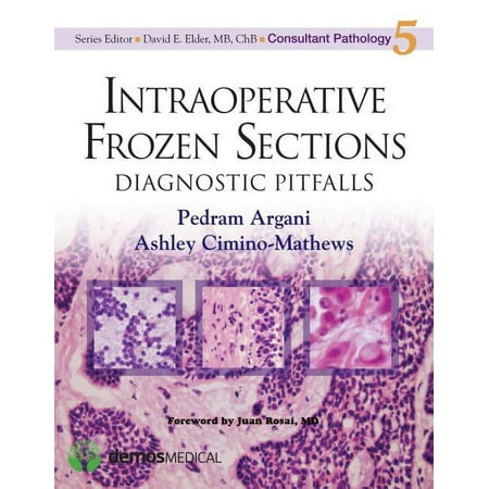 UPC: 9781936287970 | Consultant Pathology: Intraoperative Frozen Sections: Diagnostic Pitfalls (Hardcover)