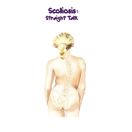 Scoliosis: Straight Talk - eBook