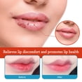thumbnail image 3 of JFBUJC 20g Lip Balm Cheilitis Treatment Cream, 3 of 5
