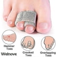 thumbnail image 3 of 8-pack Of Hammer Toe Straighteners For Straightening Hammer Toes, Broken Toes, Crooked Toes And Overlapping Toes, 3 of 5