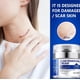 thumbnail image 3 of Elaimei nueva crema para cicatrices tipo prensa estrías quemaduras cesárea cicatriz eliminación crema 50ml, 3 of 5