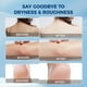 thumbnail image 4 of Crema de urea OUKEYA 40% para pies, manos, rodillas y codos 150 ml, 4 of 8