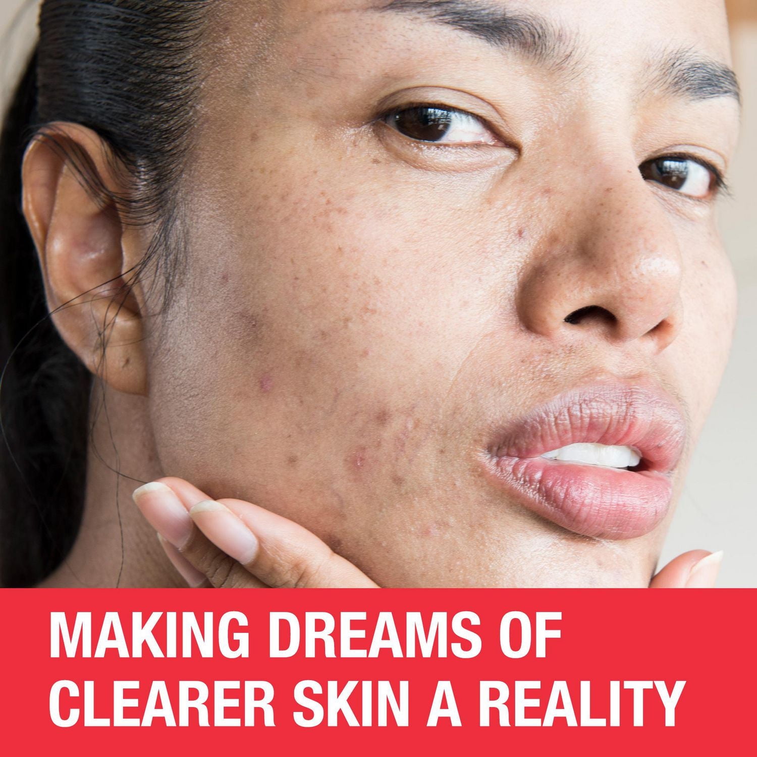 Neutrogena Traitement PM Marques d'acné tenaces - Acné, Soin de la peau au rétinol, Vitamine A - exfoliant marques d'acné - Sans parfum