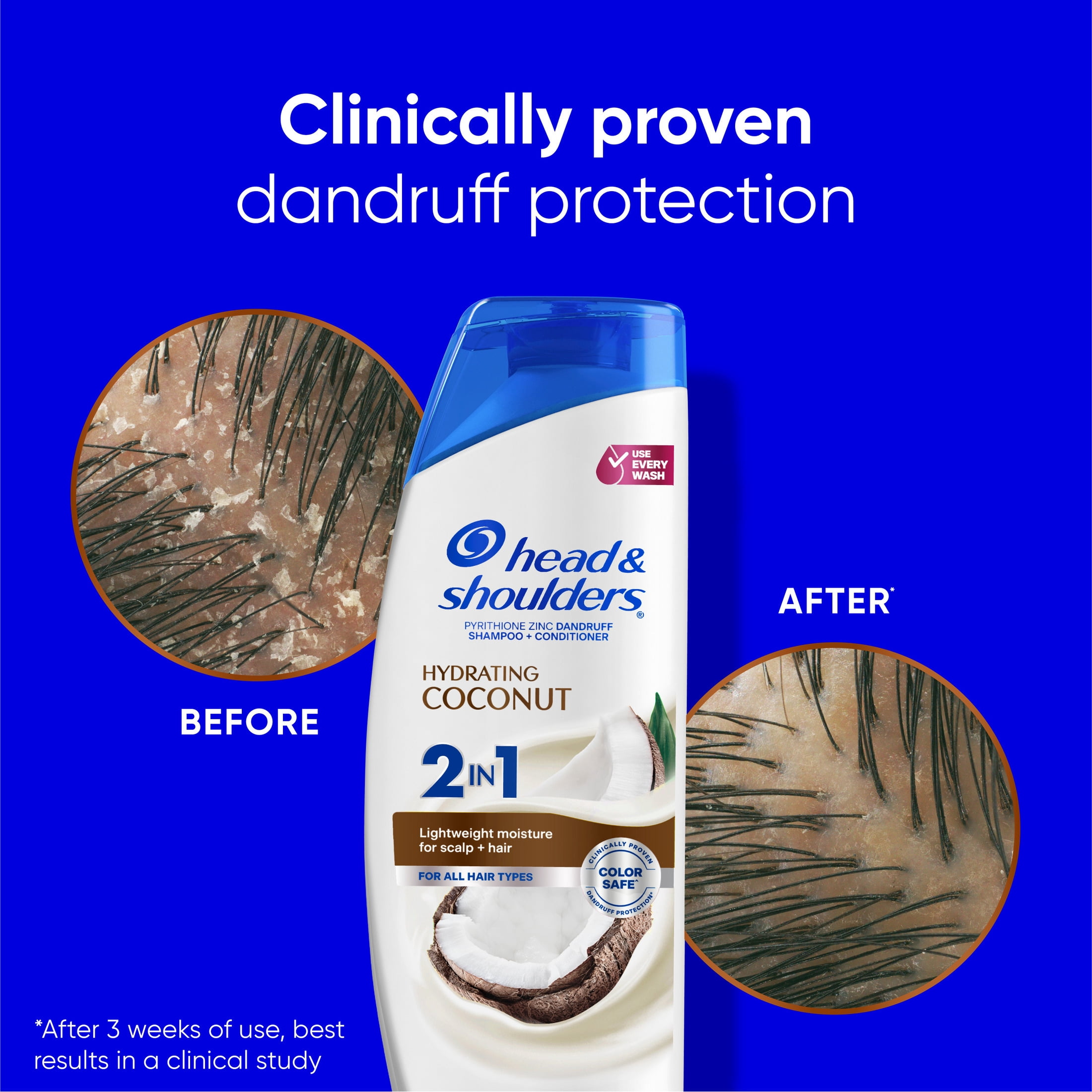 Head and Shoulders Dandruff 2 in 1 Shampoo and Conditioner, Hydrating Coconut, Lightweight Moisture, Color Safe, 12.5 fl oz