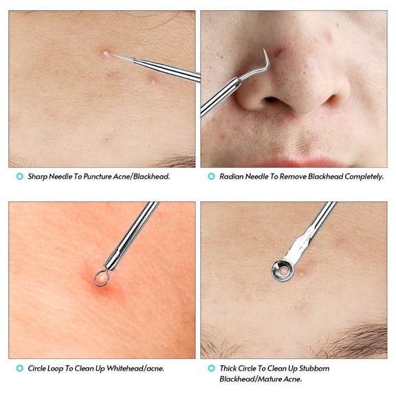 ACDANC Blackhead Remover Pimple Popper Tool Kit for Pimple Blemish Comedone Acne Zit Whitehead Face Chin Nose Forehead Cheek Body