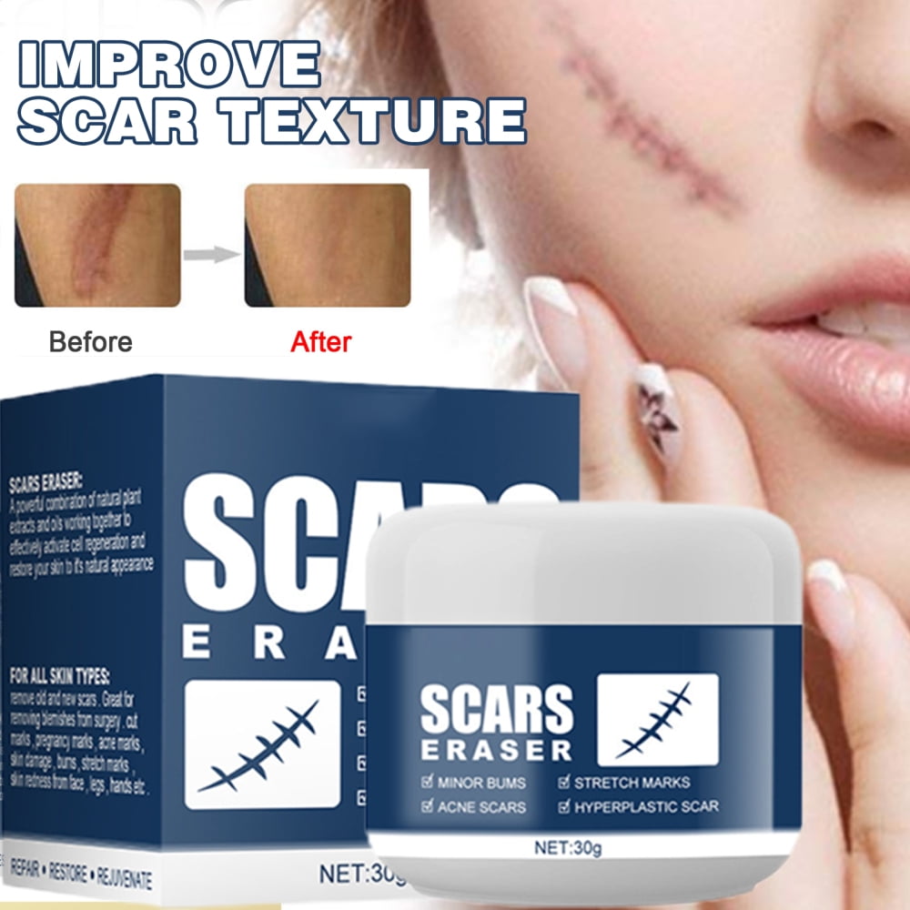 Scar Removal Cream for Burn Repair and Scar Fading Face Skin Repair Cream - Scar Removal Cream for Burn Repair and Scar Fading Face Skin Repair Cream -
