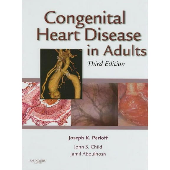 Congenital Heart Disease in Adults, (Hardcover)