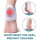thumbnail image 3 of Heel Support For Plantar Fasciitis, 3pcs Thick Heel Sleeves, Silicone Heel Protector Pads, Heel Cushion For Bone Spur And Heel Spur Pain Relief, Crack, 3 of 5
