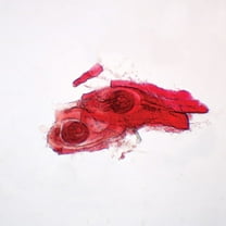 Trichinella Spiralis Encysted Larvae Slide, W.M.