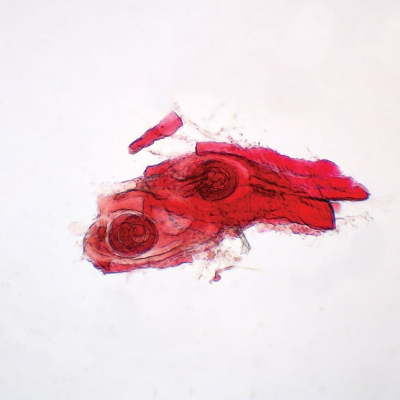 Trichinella Spiralis Encysted Larvae Slide, W.M.