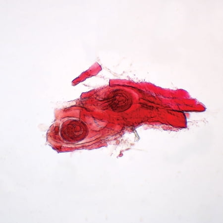 Trichinella Spiralis Encysted Larvae Slide  W.M. price history on PriceWatchPro