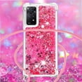 thumbnail image 4 of Funda FOXDOCK para Xiaomi Redmi Note 11 Pro 4G/5G con Cuerda Ajustable, Brillo Líquido, Protección Antigolpes y Lente – Ideal para Regalo, 4 of 6