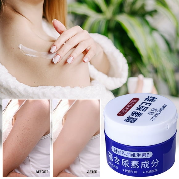 WKWeiS Ve Urea Cream Urea Cream Moisturizes, Moisturizes, Moisturizes, and Protects The Skin From Dry Cracks 100G Todays Clearance Deal