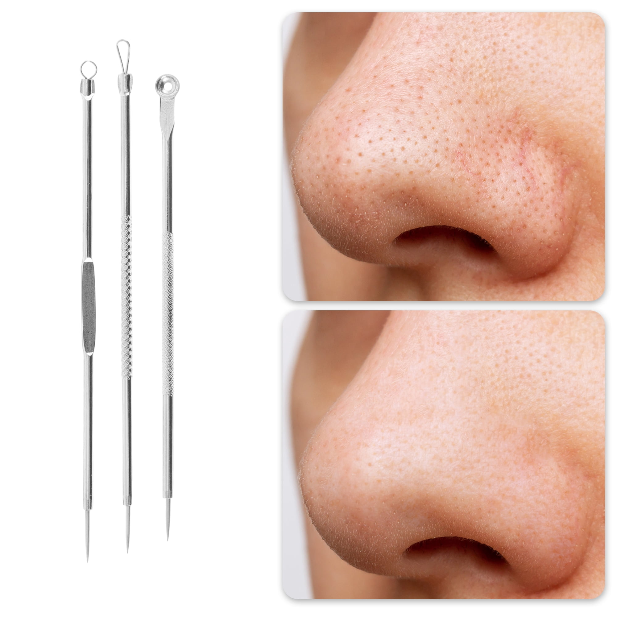 Unique Bargains Portable Diagonal Clamp Pimple Extractor Tool Kit Silver Tone 1 Set