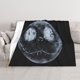 thumbnail image 1 of Manta de aire acondicionado de Pesadilla antes de Navidad, manta de felpa de franela suave, manta de cama, manta de sofá para adolescentes, niños, niñas, niños, hombres, mujeres, 1 of 8