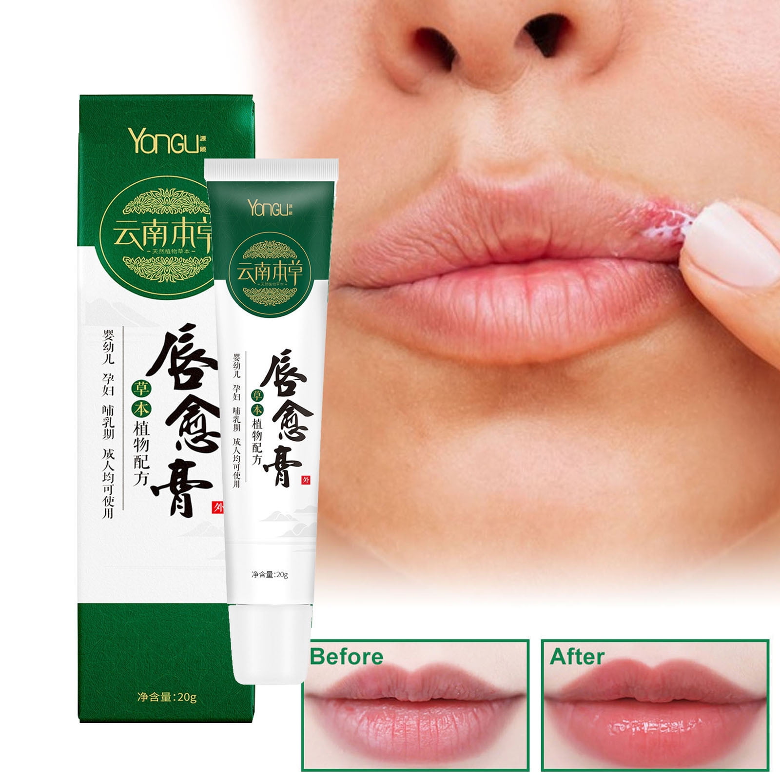YiFudd LongLasting Lip Care, Herbal Medicated Lip Balm，Medicated Lip