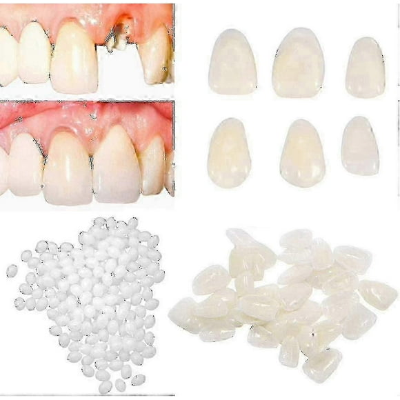 2pcs Temporary Tooth Repair Kit For Filling The Missing Broken Tooth And Gaps-moldable Fake Teeth.