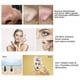 thumbnail image 5 of Ultrasonic Skin Scrubber Facial Cleaner Ion Acne Blackhead Remover Peeling Shovel Cleaner Facial Massager Face Lift Machine Afortunado Sencillez, 5 of 5