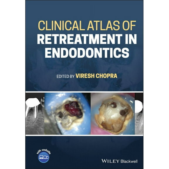 Clinical Atlas of Retreatment in Endodontics (Hardcover)