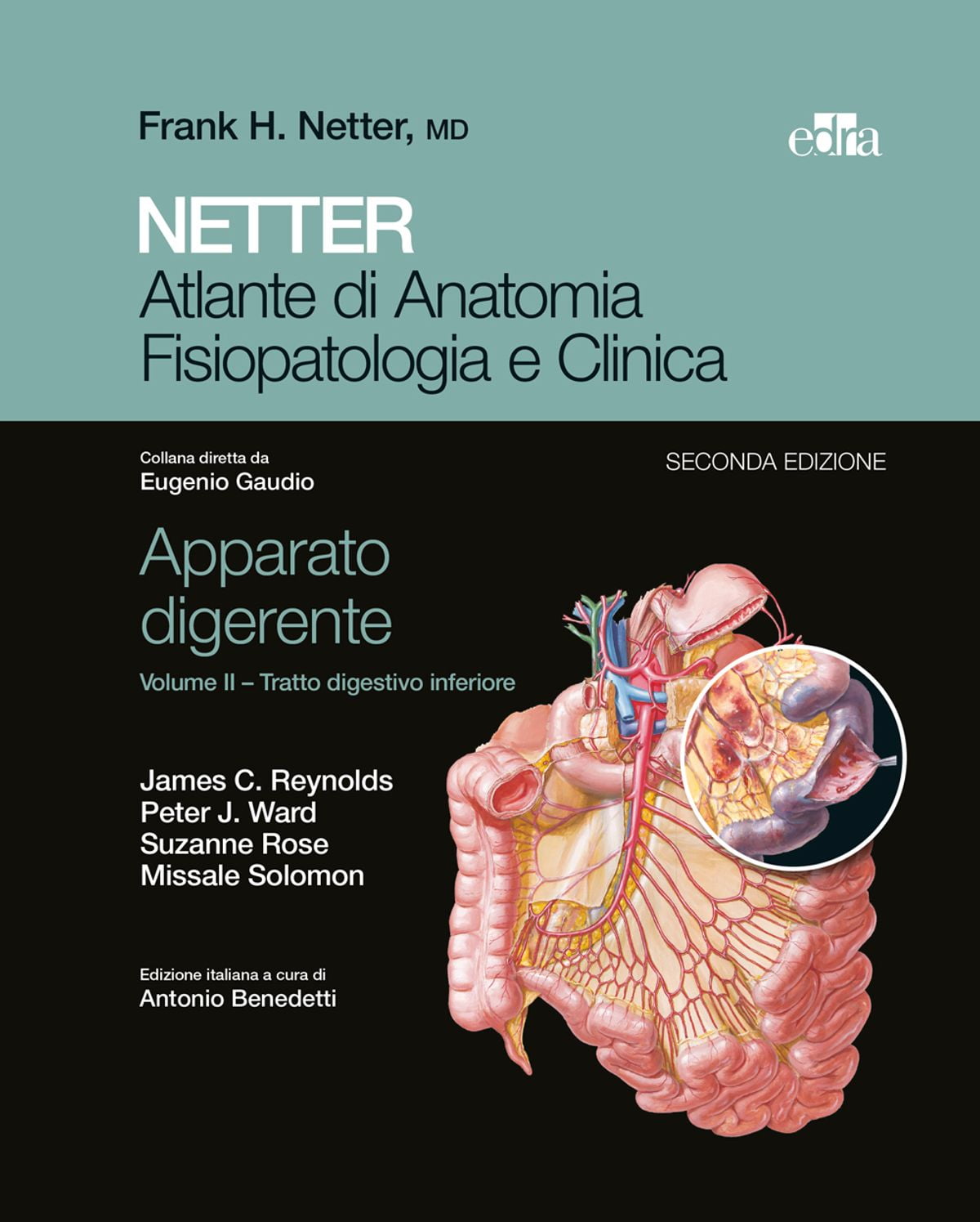 esofago di barrett diet esofago di barrett diet