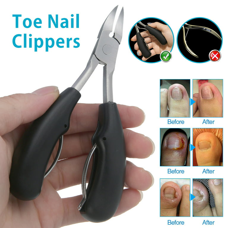 Thick Toenail Toe Nail Clippers Scissors Fungus Ingrown Chiropody Podiatry  Plier