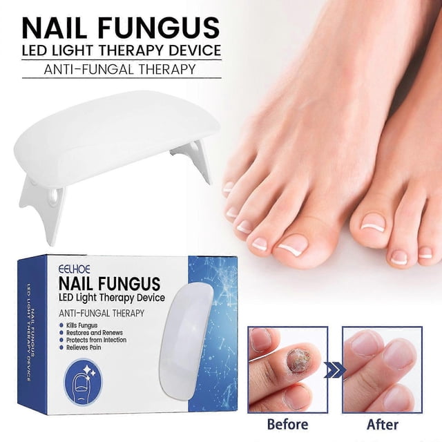 Nail Led Light Therapy-device,nail Repair Instrument To Prevents Broken Nails And Rotten Nails GuanGuan
