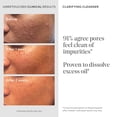 thumbnail image 4 of Murad Acne Control Clarifying Cleanser – Salicylic Acid & Green Tea Formula for Acne, Deep Pore Cleansing, Oil Control & Breakout Prevention for Clear, Balanced, Healthy-Looking Skin (5 Fl Oz), 4 of 8