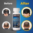 thumbnail image 2 of Tratamiento para el crecimiento del cabello Kirkland Minoxidil 5% para hombres durante 6 meses, 2 of 7