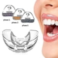 thumbnail image 1 of Myobrace Dental Orthodontic Braces - Corrects Teeth Alignment, 3 Phase, 1 of 5