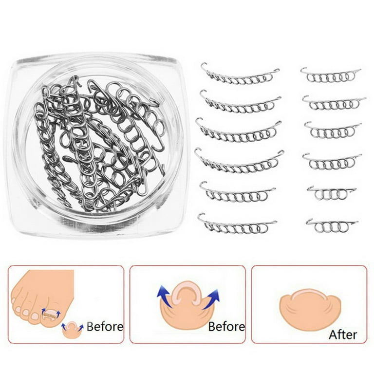 Fixer 6 outlet