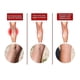 thumbnail image 2 of Varicose Care Patch Leg Massage Relieve Soreness Earthworm Leg Vein Car, 2 of 5