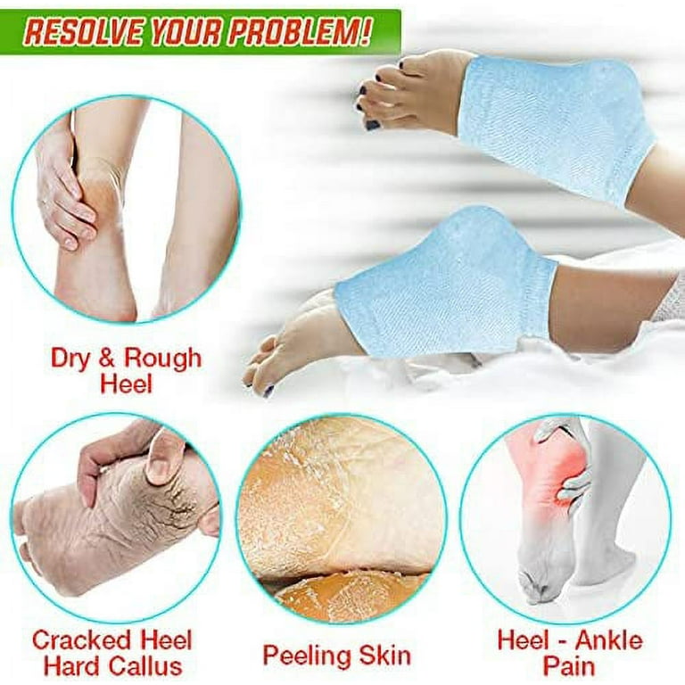 Moisturising Socks Lotion Gel for Dry Cracked Heels Pack Spa Gel