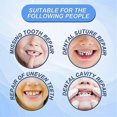 thumbnail image 5 of 1-3pcs Resin False Teeth Solid Gums Modification Of Temporary Filling Materials Restorative Dentistry Oral Hygiene Denture Care, 5 of 5