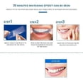 thumbnail image 3 of 5D Teeth Whitening Strips - Mild Stain Removal & Brightening Patches, Effective Whitening Solution for Outdoor Travel, 3 of 5