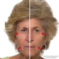 thumbnail image 5 of Plexaderm Rapid Reduction Serum - New Single Use Pods - Age-Defying Eye Treatment - Reduce the Look of Under-Eye Bags & Wrinkles, Diminish the Appearance of Dark Circles, Fine Lines & Crow’s Feet, 5 of 9