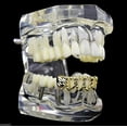 thumbnail image 3 of 14K Gold Plated Grillz Diamond-Cut Lower Bottom Teeth Four 4 Open Face Hip Hop Grills, 3 of 5