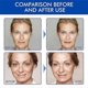 thumbnail image 2 of Stock Solution Facial Serum, Btx Face Serum,Anti-Ageing Serum To Reduce Fine Lines, Wrinkles, Plump Skin 30ml, 2 of 5