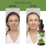 Moringa Seed Oil (Ben Oil / Moringa Oleifera) – Pure Cold-Pressed Natural Oil for Skin & Hair by Relaxcation | 0.5 fl oz